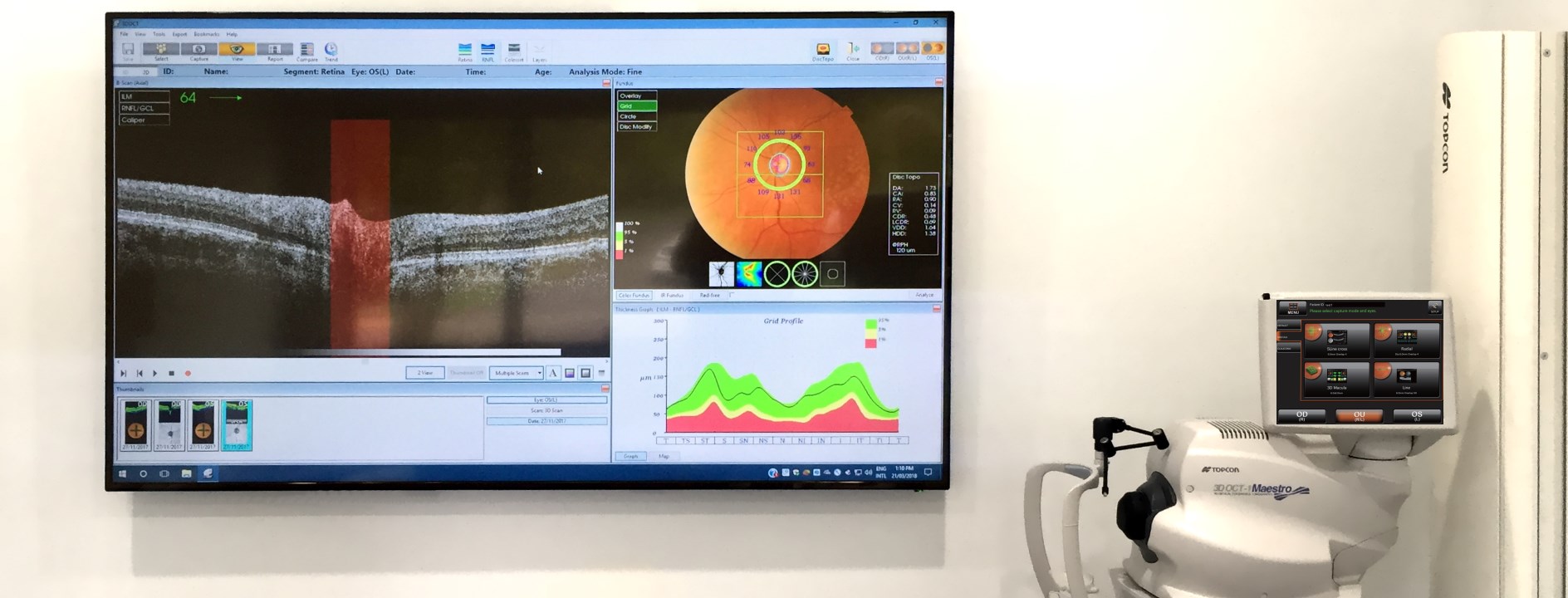 Sports Vision Training